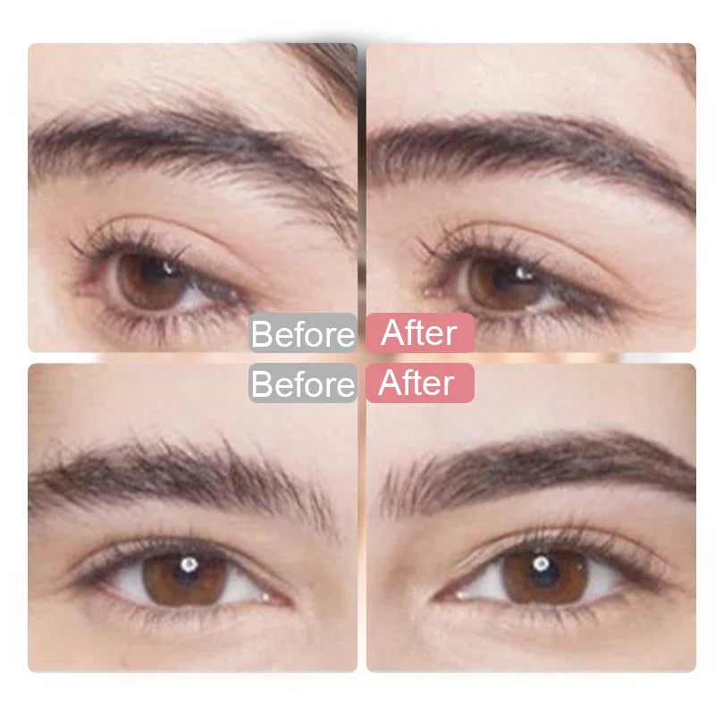 Electric Hair Remover for Women